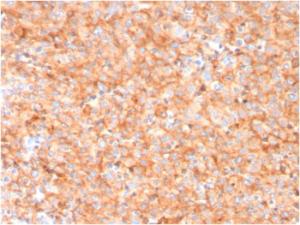 Antibody anti-CD63 LAMP33315 100 µg