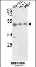 Anti-TRIM64 Rabbit Polyclonal Antibody