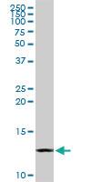 Anti-CSTB Rabbit Polyclonal Antibody