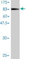 Anti-RABL6 Mouse Monoclonal Antibody [clone: 2E11-1F10]