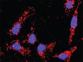 Anti-TGFB2 + APP Antibody Pair