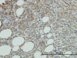 Anti-PROCR Mouse Monoclonal Antibody [clone: M2]