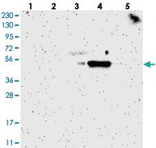 Anti-SELENBP1 Rabbit Polyclonal Antibody