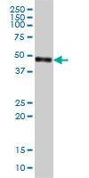 Anti-CPVL Mouse Monoclonal Antibody [clone: 2G5-1C1]