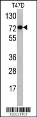 Anti-PID/MTA2 Rabbit Polyclonal Antibody