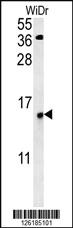 Anti-KXD1 Rabbit Polyclonal Antibody