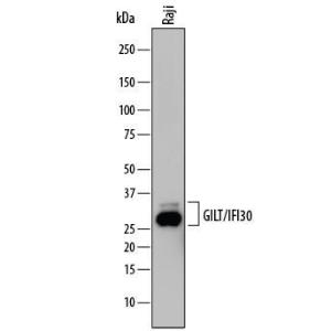 Anti-IFI30 Mouse Monoclonal Antibody [clone: 844623]