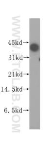 Anti-TIA1 Rabbit Polyclonal Antibody