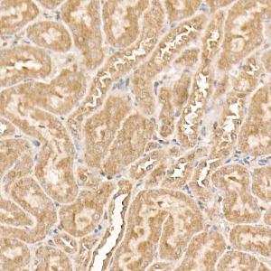 Immunohistochemistry analysis of paraffin-embedded mouse kidney using Anti-AKT1 Antibody [ARC51585] (A308667) at a dilution of 1:100 (40x lens). Perform high pressure antigen retrieval with 10 mM citrate buffer pH 6.0 before commencing with IHC staining protocol.