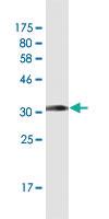 Anti-CCL2 Mouse Monoclonal Antibody [clone: 1F10]