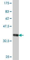 Anti-RPN2 Mouse Polyclonal Antibody