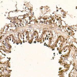 Immunohistochemistry analysis of paraffin-embedded rat lung using Anti-AKT1 Antibody [ARC51585] (A308667) at a dilution of 1:100 (40x lens). Perform high pressure antigen retrieval with 10 mM citrate buffer pH 6.0 before commencing with IHC staining protocol.