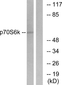 Western blot analysis of lysates from HeLa cells, treated with Insulin 10mU/ml 5' using Anti-p70 S6 Kinase Antibody. The right hand lane represents a negative control, where the antibody is blocked by the immunising peptide.