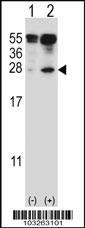 Anti-IL27 Rabbit Polyclonal Antibody