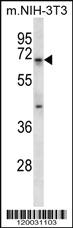 Anti-PID/MTA2 Rabbit Polyclonal Antibody