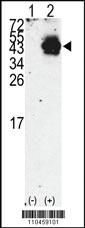 Anti-PDX1 Rabbit Polyclonal Antibody