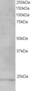 EB06276 staining (1µg/ml) of Human Testis lysate (RIPA buffer, 35µg total protein per lane).  Primary incubated for 1 hour.  Detected by western blot using chemiluminescence.