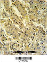 Anti-PSG7 Rabbit Polyclonal Antibody (HRP (Horseradish Peroxidase))