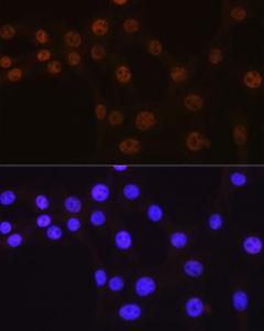 Immunofluorescence analysis of NIH/3T3 using Anti-AKT1 Antibody [ARC51585] (A308667) at a dilution of 1:100 (40x lens). DAPI was used to stain the cell nuclei (blue).