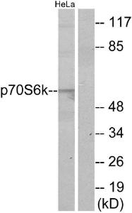 Western blot analysis of lysates from HeLa cells using Anti-p70 S6 Kinase Antibody. The right hand lane represents a negative control, where the antibody is blocked by the immunising peptide