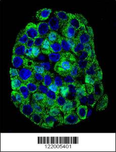 Anti-Solute Carrier Family 10 Rabbit Polyclonal Antibody (APC (Allophycocyanin))