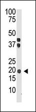 Anti-IL28 Rabbit Polyclonal Antibody