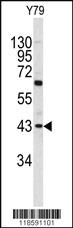 Anti-PRELP Rabbit Polyclonal Antibody