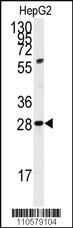 Anti-CSNK1G1 Rabbit Polyclonal Antibody