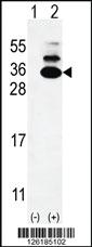 Anti-KXD1 Rabbit Polyclonal Antibody