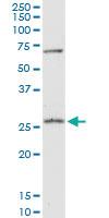 Anti-PRDX4 Mouse Polyclonal Antibody