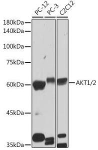 Western blot analysis of extracts of various cell lines, using Anti-AKT1 +AKT2 Antibody [ARC2651] (A308668) at 1:1,000 dilution The secondary antibody was Goat Anti-Rabbit IgG H&L Antibody (HRP) at 1:10,000 dilution Lysates/proteins were present at 25 µg per lane