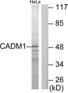 Western blot analysis of lysates from HeLa cells using Anti-CADM1 Antibody. The right hand lane represents a negative control, where the antibody is blocked by the immunising peptide