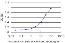 Anti-SMO Mouse Monoclonal Antibody [clone: 2F8]