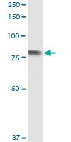 Anti-SEMA4A Polyclonal Antibody Pair