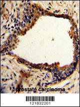 Anti-N-myc Downstream Regulated Gene 1 Protein Rabbit Polyclonal Antibody (AP (Alkaline Phosphatase))