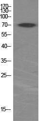 Western blot analysis of various cells using Anti-p70 S6 Kinase Antibody