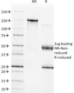 SDS-PAGE analysis of Anti-TIMP1 Antibody [2A5] under non-reduced and reduced conditions; showing intact IgG and intact heavy and light chains, respectively SDS-PAGE analysis confirms the integrity and purity of the antibody