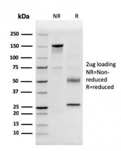 Antibody anti-CD63 LAMP33315 100 µg