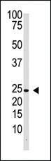 Anti-IFNL1 Rabbit Polyclonal Antibody