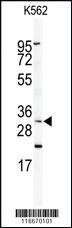 Anti-IPF Rabbit Polyclonal Antibody