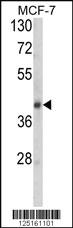 Anti-SERPINA9 Rabbit Polyclonal Antibody