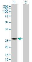 Anti-PRDX4 Mouse Polyclonal Antibody