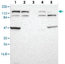 Anti-DIAPH2 Rabbit Polyclonal Antibody