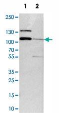 Anti-DIAPH2 Rabbit Polyclonal Antibody