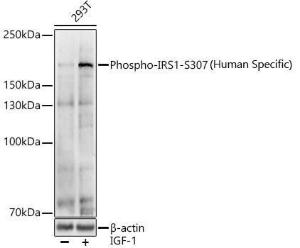 Anti-IRS1 Rabbit Polyclonal Antibody