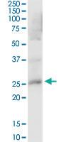 Anti-PRDX4 Mouse Polyclonal Antibody