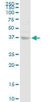 Anti-ANXA10 Rabbit Polyclonal Antibody