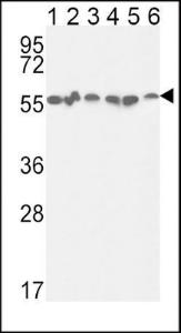 Anti-GPI Rabbit Polyclonal Antibody (PE (Phycoerythrin))