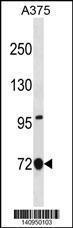 Anti-ANXA6 Rabbit Polyclonal Antibody (PE (Phycoerythrin))