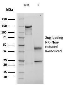 SDS-PAGE analysis of Anti-TIMP1 Antibody [rTIMP1/1710] under non-reduced and reduced conditions; showing intact IgG and intact heavy and light chains, respectively SDS-PAGE analysis confirms the integrity and purity of the antibody